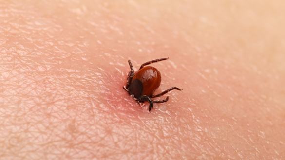 Anaplasmos (Ehrlichios, fästingfeber) – symtom, diagnos och behandling